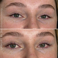 Lash and Brow Lift System - Solution TWO